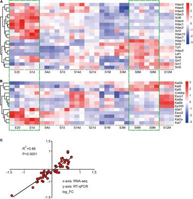 Expression of Protein Acetylation Regulators During Peripheral Nerve Development, Injury, and Regeneration